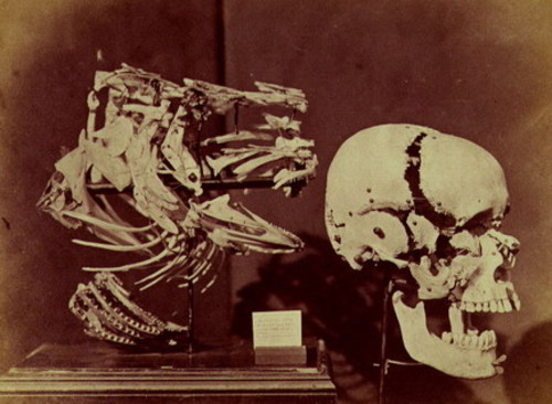 Cod's head and shoulders and human skull, 1857